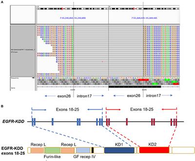 Lung Adenocarcinoma Patient Harboring EGFR-KDD Achieve Durable Response to Afatinib: A Case Report and Literature Review
